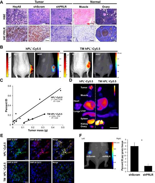 Prolactin Receptor-Mediated Internalization of Imaging Agents Detects Epithelial Ovarian Cancer with Enhanced Sensitivity and Specificity