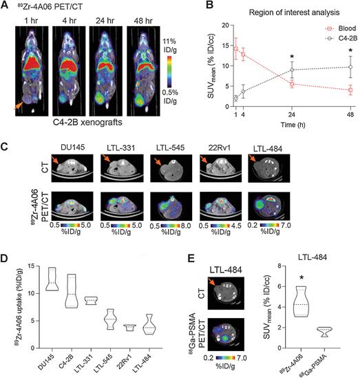 CUB Domain-Containing Protein 1 (CDCP1) Is a Target for Radioligand Therapy in Castration-Resistant Prostate Cancer, including PSMA Null Disease