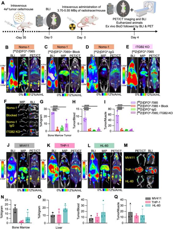 Effective imaging and treatment of Acute Myeloid Leukemia with radiotheranostics targeting the activated conformation of integrin-βeta2